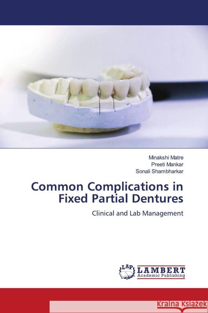 Common Complications in Fixed Partial Dentures Minakshi Matre Preeti Mankar Sonali Shambharkar 9786207450978 LAP Lambert Academic Publishing - książka