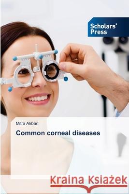 Common corneal diseases Akbari, Mitra 9786208847609 Scholars' Press - książka