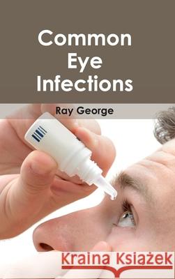 Common Eye Infections Ray George 9781632410948 Hayle Medical - książka