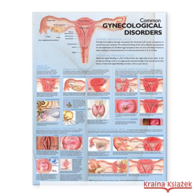 Common Gynecological Disorders Anatomical Chart   9780781773508  - książka