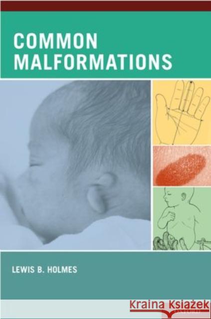 Common Malformations Lewis B. Holmes 9780195136029 Oxford University Press, USA - książka