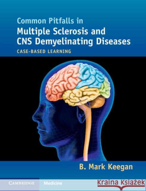 Common Pitfalls in Multiple Sclerosis and CNS Demyelinating Diseases: Case-Based Learning Mark Keegan B. Mark Keegan 9781107680401 Cambridge University Press - książka