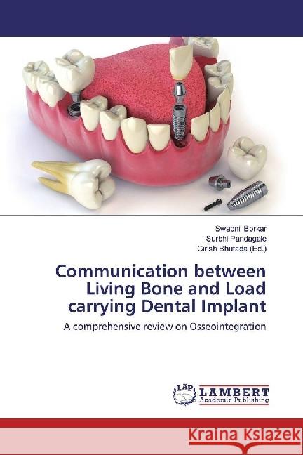 Communication between Living Bone and Load carrying Dental Implant : A comprehensive review on Osseointegration Borkar, Swapnil; Pandagale, Surbhi 9783659849268 LAP Lambert Academic Publishing - książka