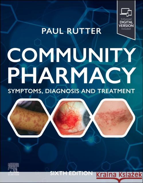 Community Pharmacy: Symptoms, Diagnosis and Treatment: Symptoms, Diagnosis and Treatment Paul Rutter 9780443246197 Elsevier - książka