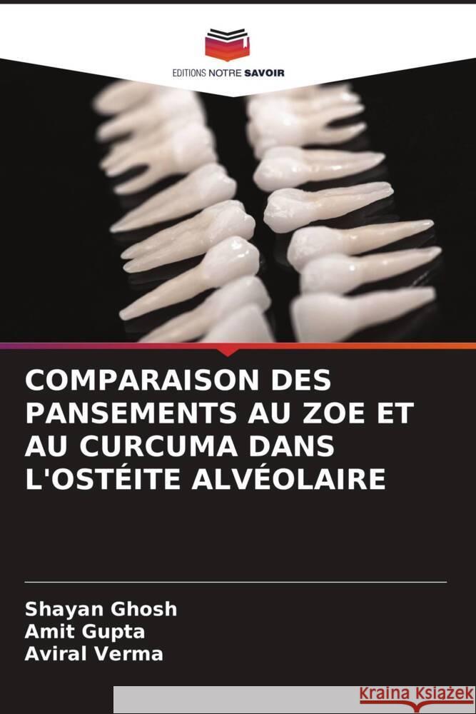 Comparaison Des Pansements Au Zoe Et Au Curcuma Dans l'Ost?ite Alv?olaire Shayan Ghosh Amit Gupta Aviral Verma 9786208053970 Editions Notre Savoir - książka