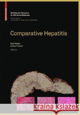 Comparative Hepatitis  9783764385576 BIRKHAUSER VERLAG AG - książka