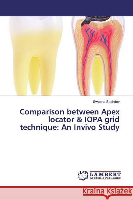 Comparison between Apex locator & IOPA grid technique: An Invivo Study Sachdev, Swapna 9783330077348 LAP Lambert Academic Publishing - książka