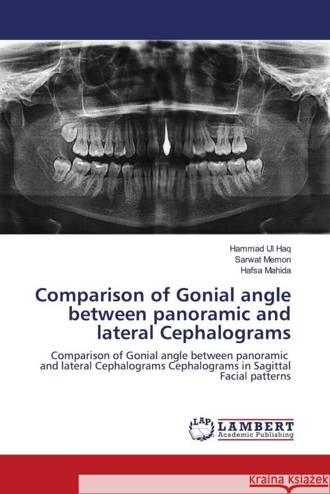 Comparison of Gonial angle between panoramic and lateral Cephalograms Ul Haq, Hammad, Memon, Sarwat, Mahida, Hafsa 9786202922166 LAP Lambert Academic Publishing - książka
