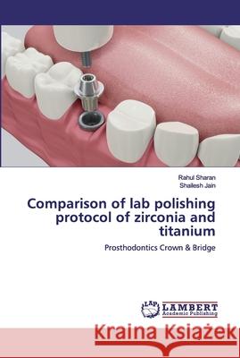 Comparison of lab polishing protocol of zirconia and titanium Rahul Sharan Shailesh Jain 9786200443168 LAP Lambert Academic Publishing - książka