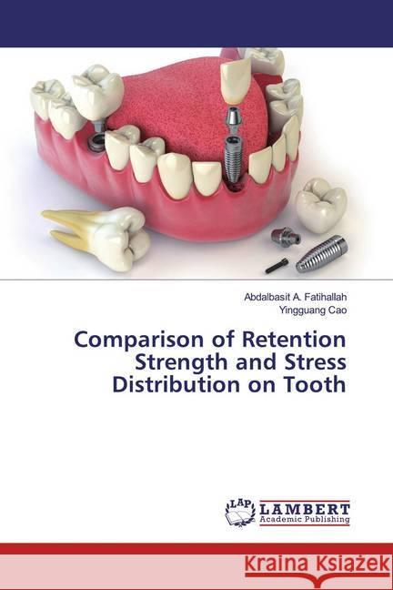 Comparison of Retention Strength and Stress Distribution on Tooth Fatihallah, Abdalbasit A.; Cao, Yingguang 9783330321649 LAP Lambert Academic Publishing - książka