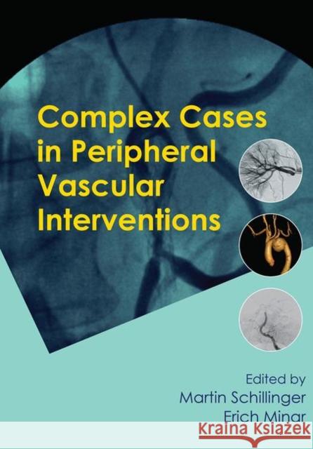 Complex Cases in Peripheral Vascular Interventions Martin Schillinger Erich Minar 9780367445997 CRC Press - książka