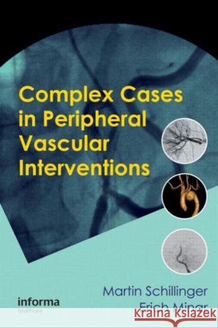 Complex Cases in Peripheral Vascular Interventions Martin Schillinger Erich Minar 9781841847313 Informa Healthcare - książka