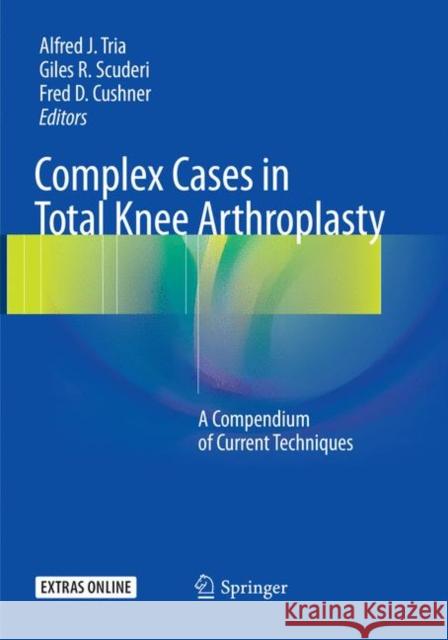 Complex Cases in Total Knee Arthroplasty: A Compendium of Current Techniques Tria, Alfred J. 9783030098865 Springer - książka