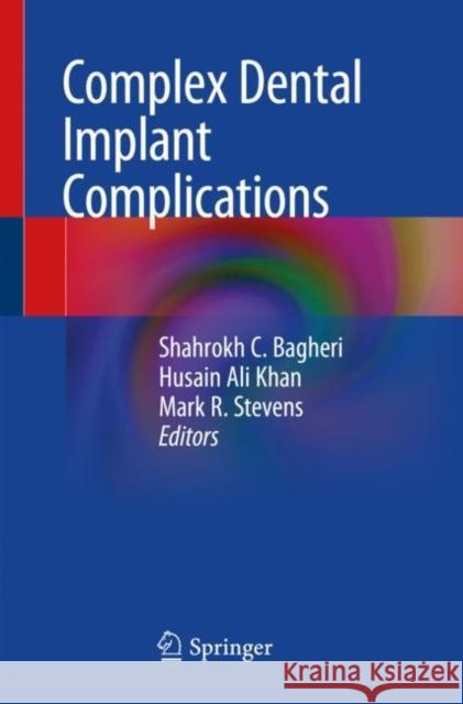 Complex Dental Implant Complications Shahrokh C. Bagheri Husain Ali Khan Mark R. Stevens 9783030470142 Springer - książka