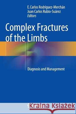 Complex Fractures of the Limbs: Diagnosis and Management Rodríguez-Merchán, E. Carlos 9783319044408 Springer - książka