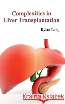 Complexities in Liver Transplantation Dylan Long 9781632420886 Foster Academics - książka