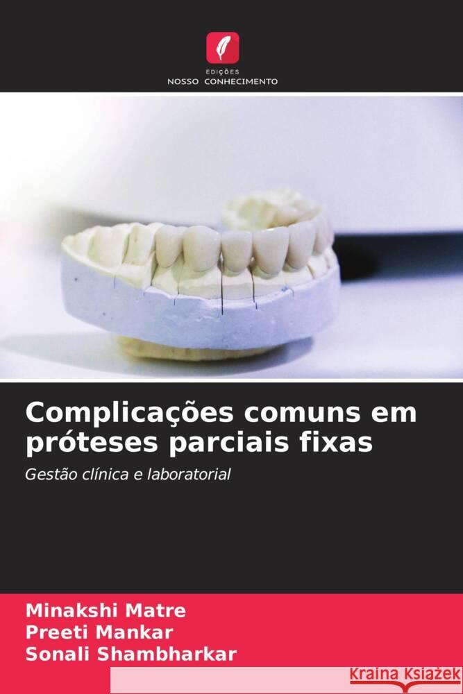 Complica??es comuns em pr?teses parciais fixas Minakshi Matre Preeti Mankar Sonali Shambharkar 9786207013623 Edicoes Nosso Conhecimento - książka