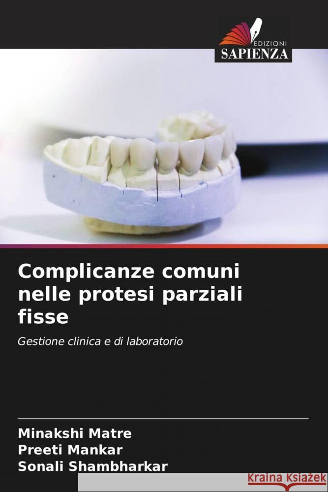 Complicanze comuni nelle protesi parziali fisse Minakshi Matre Preeti Mankar Sonali Shambharkar 9786207013661 Edizioni Sapienza - książka