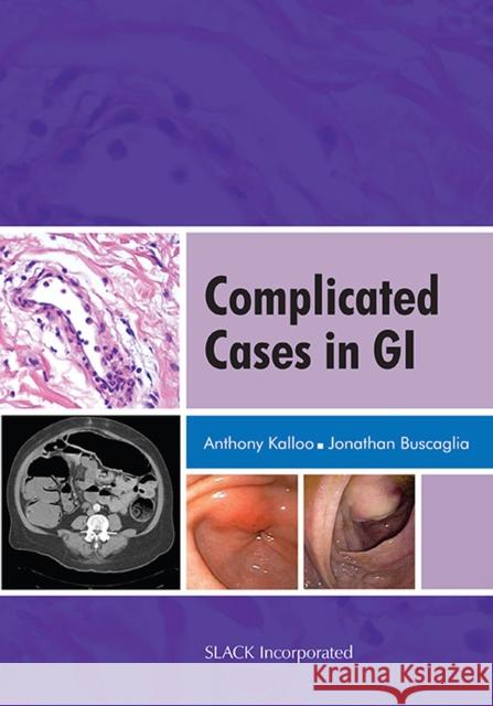 Complicated Cases in GI A. Kalloo 9781556428111 Not Avail - książka