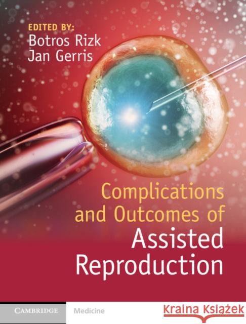 Complications and Outcomes of Assisted Reproduction Botros Rizk Jan Gerris  9781107055643 Cambridge University Press - książka