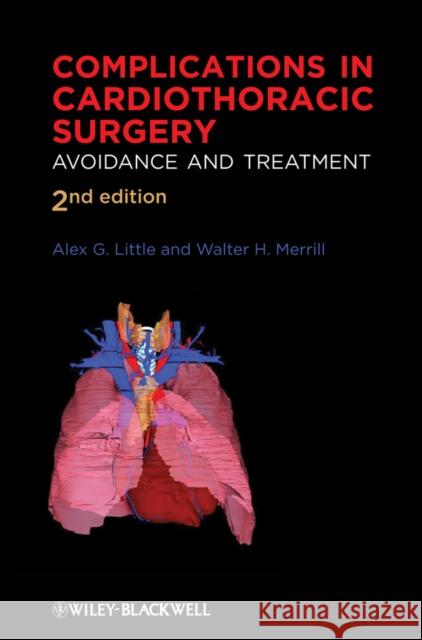 Complications in Cardiothoracic Surgery: Avoidance and Treatment Little, Alex G. 9781405181037 Wiley-Blackwell - książka