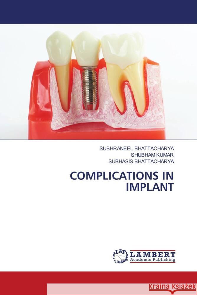 COMPLICATIONS IN IMPLANT BHATTACHARYA, SUBHRANEEL, Kumar, Shubham, Bhattacharya, Subhasis 9786208118471 LAP Lambert Academic Publishing - książka