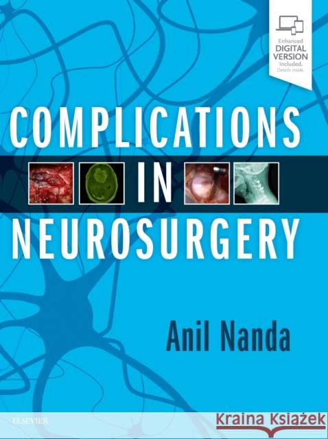 Complications in Neurosurgery Anil Nanda   9780323509619 Elsevier - Health Sciences Division - książka