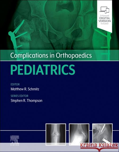 Complications in Orthopaedics: Pediatrics  9780323873970 Elsevier - Health Sciences Division - książka