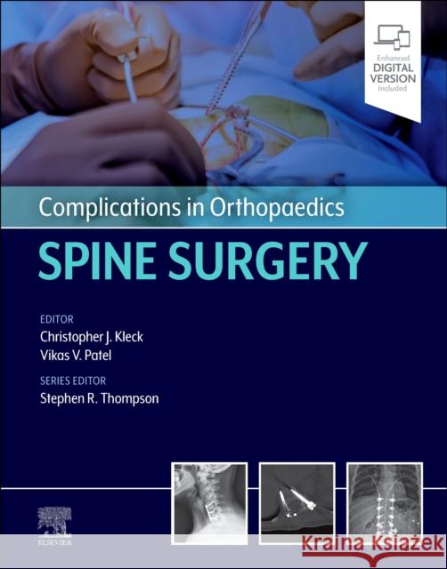 Complications in Orthopaedics: Spine Surgery  9780323880664 Elsevier - Health Sciences Division - książka