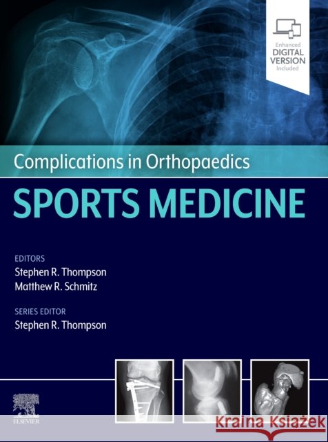 Complications in Orthopaedics: Sports Medicine Stephen R. Thompson 9780323545983 Elsevier - książka