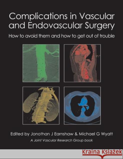 Complications in Vascular and Endovascular Surgery: How to Avoid Them and How to Get Out of Trouble Earnshaw, Jonothan J. 9781903378809  - książka