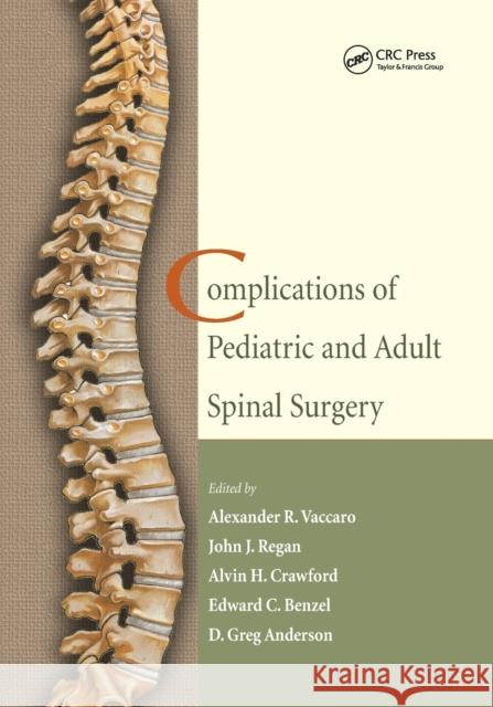 Complications of Pediatric and Adult Spinal Surgery Alexander R. Vaccaro John J. Regan Alvin H. Crawford 9780367393878 CRC Press - książka