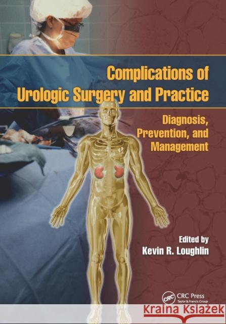 Complications of Urologic Surgery and Practice: Diagnosis, Prevention, and Management Kevin R. Loughlin   9780367453084 CRC Press - książka