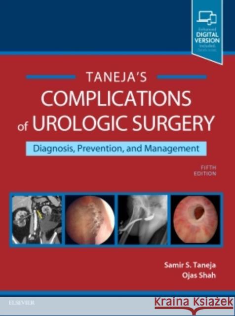 Complications of Urologic Surgery: Prevention and Management Taneja, Samir S. 9780323392426 Elsevier - książka