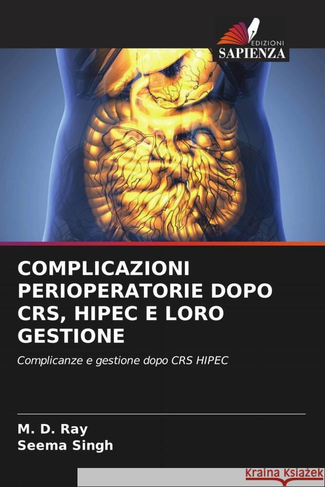 COMPLICAZIONI PERIOPERATORIE DOPO CRS, HIPEC E LORO GESTIONE Ray, M. D., Singh, Seema 9786204850535 Edizioni Sapienza - książka