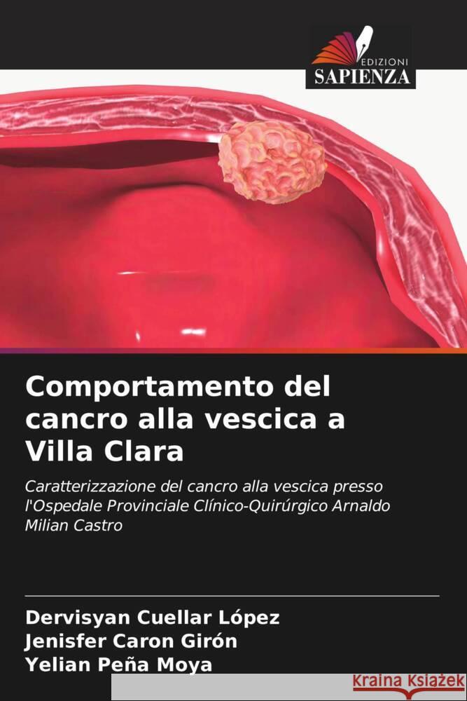 Comportamento del cancro alla vescica a Villa Clara Dervisyan Cuella Jenisfer Caro Yelian Pe? 9786206865216 Edizioni Sapienza - książka