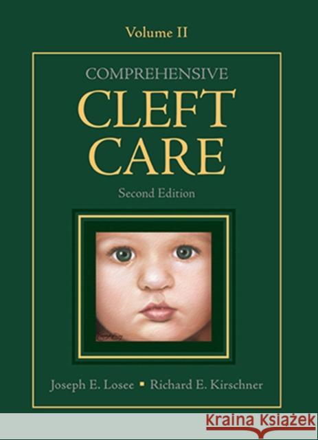 Comprehensive Cleft Care, Second Edition: Volume Two Losee, Joseph 9781626236660 Thieme Medical Publishers Inc - książka