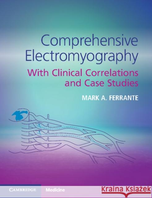 Comprehensive Electromyography: With Clinical Correlations and Case Studies Ferrante, Mark A. 9781107562035 Cambridge University Press - książka