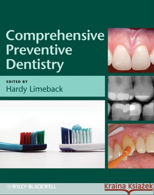 Comprehensive Preventive Dentistry Hardy Limeback Hardy Limeback 9780813821689 Wiley-Blackwell - książka