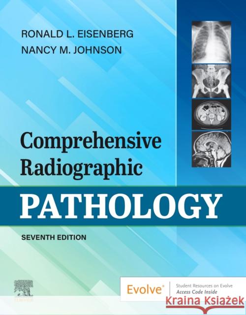 Comprehensive Radiographic Pathology Ronald L. Eisenberg Nancy M. Johnson  9780323749688 Mosby - książka