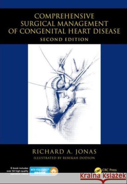 Comprehensive Surgical Management of Congenital Heart Disease Richard A Jonas 9781444112153  - książka