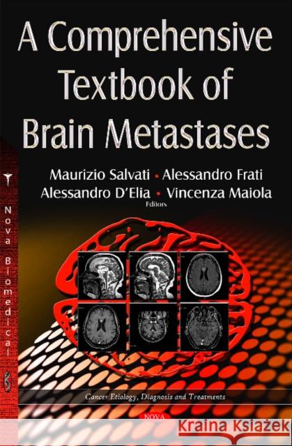Comprehensive Textbook of Brain Metastases Maurizio Salvati, Alessandro Frati, Alessandro DElia, Vincenza Maiola 9781634822947 Nova Science Publishers Inc - książka