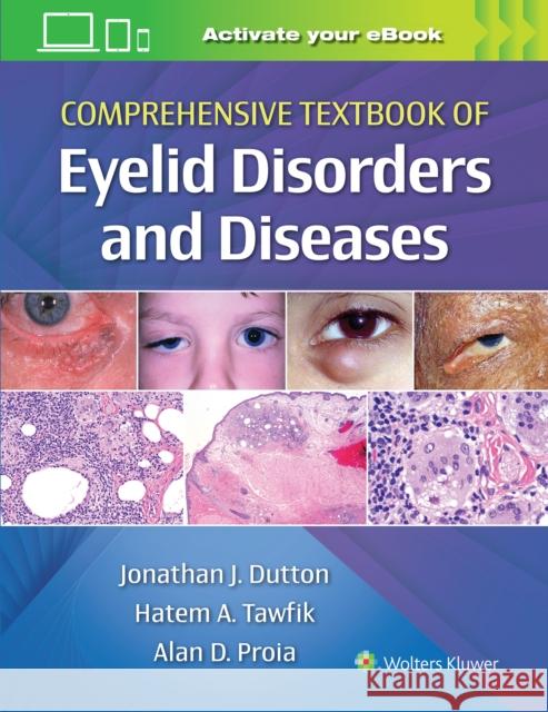 Comprehensive Textbook of Eyelid Disorders and Diseases Dutton, Jonathan 9781975146146 LWW - książka