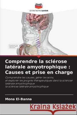 Comprendre la sclérose latérale amyotrophique : Causes et prise en charge El-Banna, Mona 9786207839438 Editions Notre Savoir - książka
