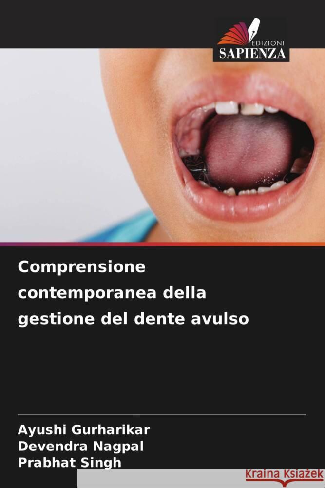 Comprensione contemporanea della gestione del dente avulso Gurharikar, Ayushi, Nagpal, Devendra, Singh, Prabhat 9786202741187 Edizioni Sapienza - książka