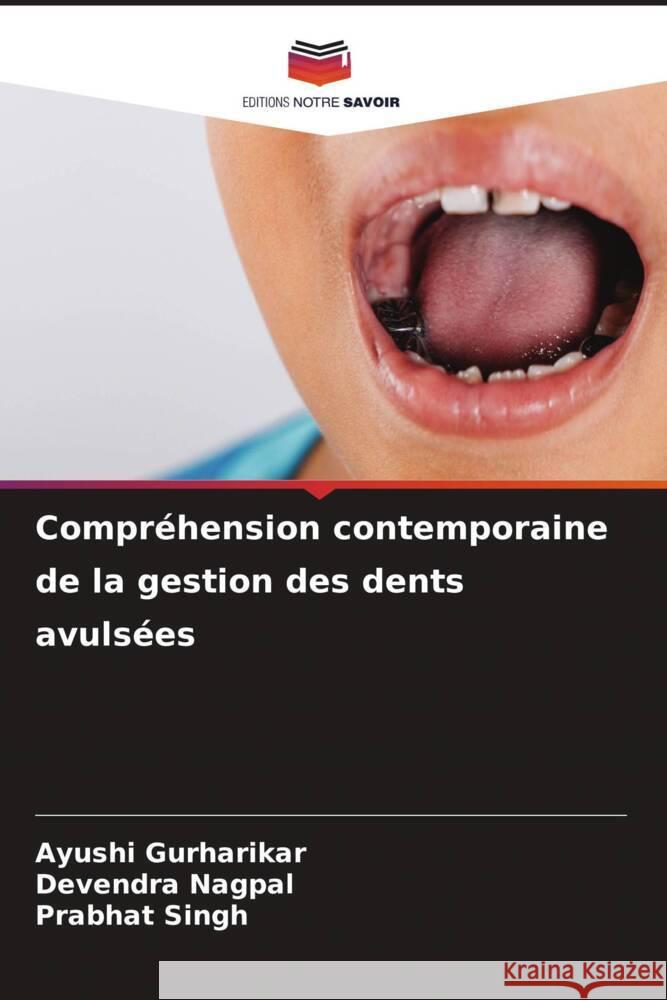 Compréhension contemporaine de la gestion des dents avulsées Gurharikar, Ayushi, Nagpal, Devendra, Singh, Prabhat 9786202741163 Editions Notre Savoir - książka
