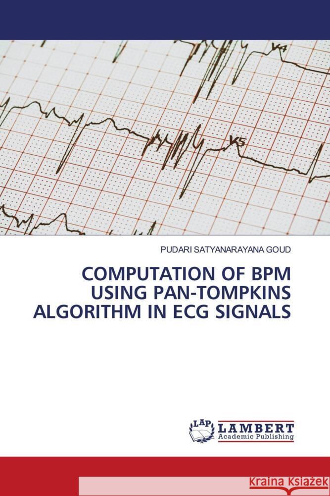 COMPUTATION OF BPM USING PAN-TOMPKINS ALGORITHM IN ECG SIGNALS Satyanarayana Goud, PUDARI 9786206686293 LAP Lambert Academic Publishing - książka