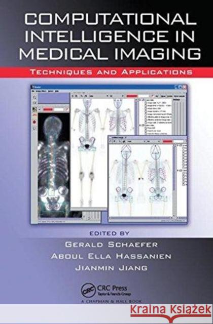 Computational Intelligence in Medical Imaging: Techniques and Applications  9781138112209 Taylor and Francis - książka