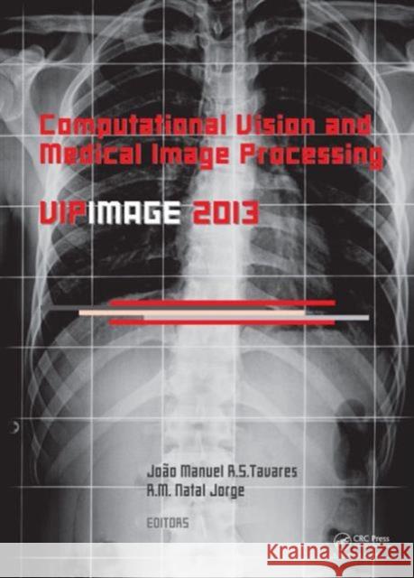 Computational Vision and Medical Image Processing IV: Vipimage 2013 Tavares, Joao Manuel Rs 9781138000810 CRC Press - książka