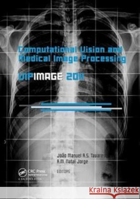 Computational Vision and Medical Image Processing: Vipimage 2011 Joao Manuel R. S. Tavares R. M. Nata 9781138112544 CRC Press - książka